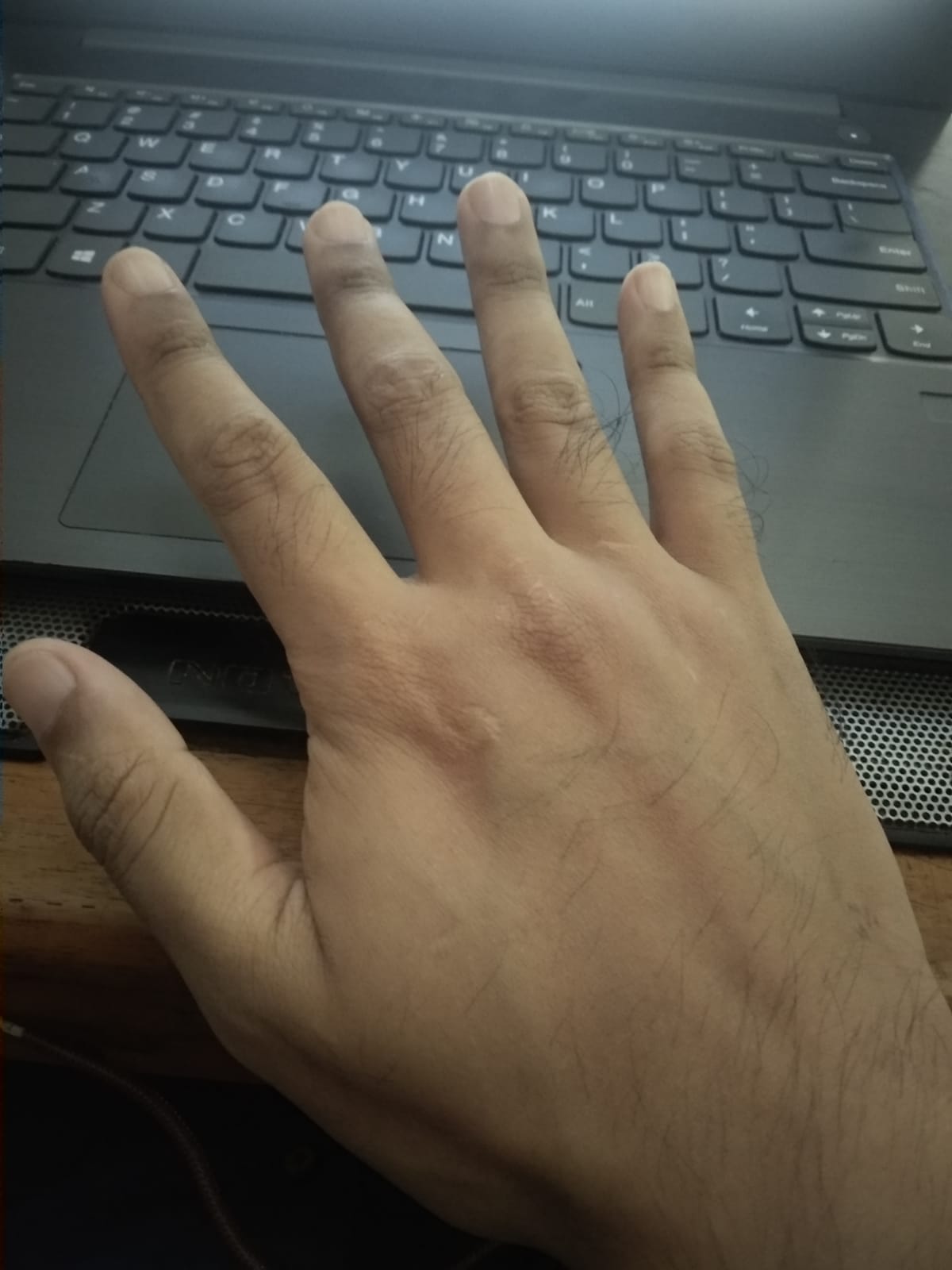 Kondisi tangan dari sudut kedua