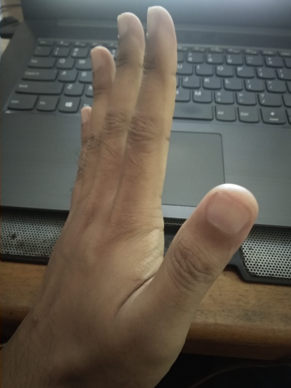 Kondisi tangan dari sudut ketiga