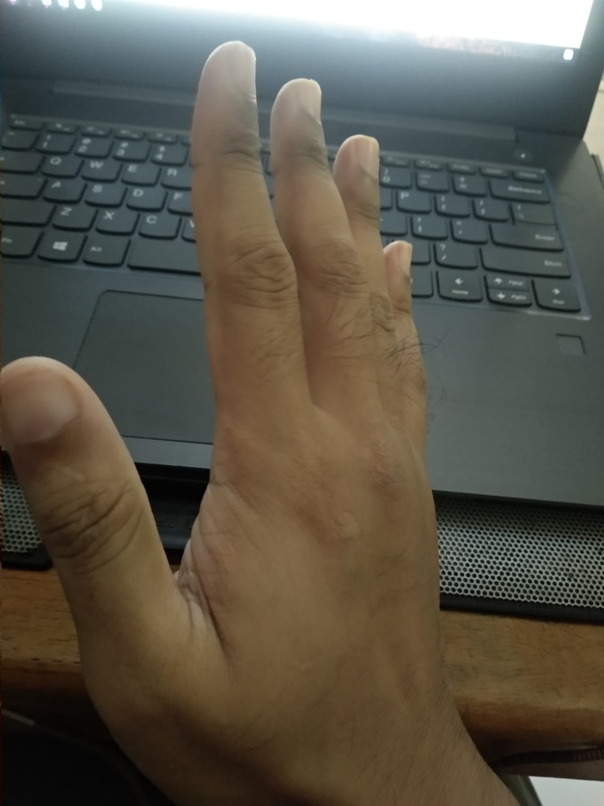 Kondisi tangan dari sudut keempat